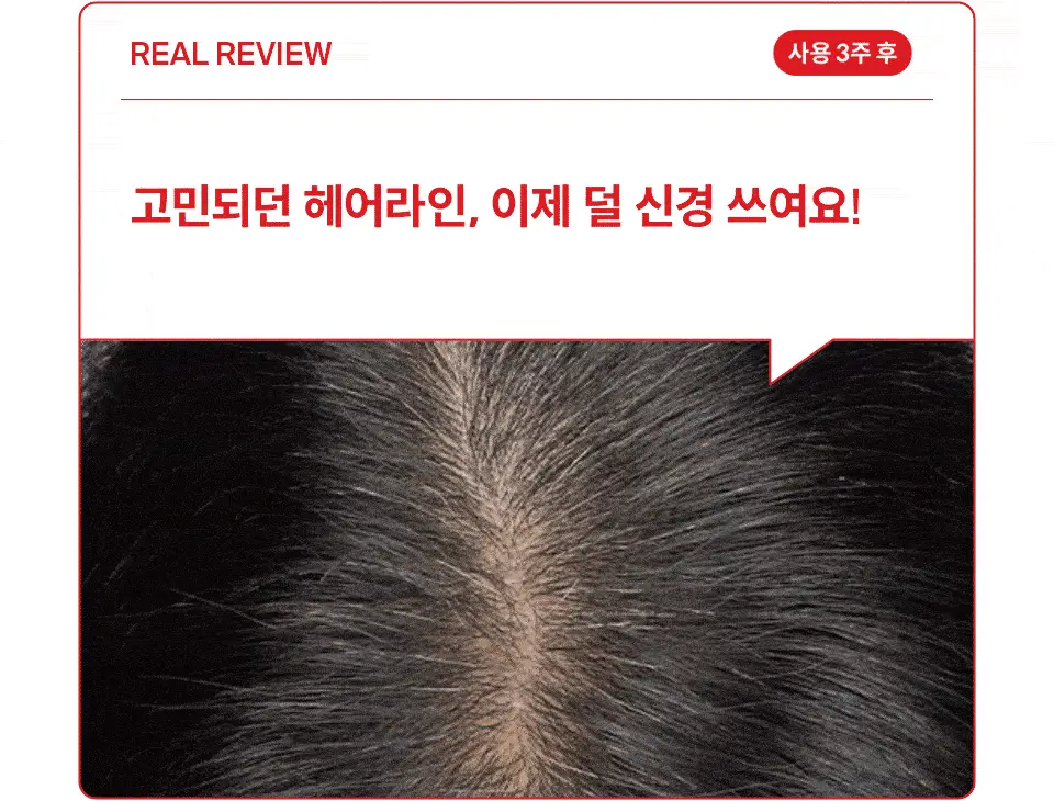 [포켓몬 에디션] 닥터포헤어 탈모완화앰플 50ml+스케일러 60g 기획 탈모케어 두피세럼 두피앰플 상세페이지 14